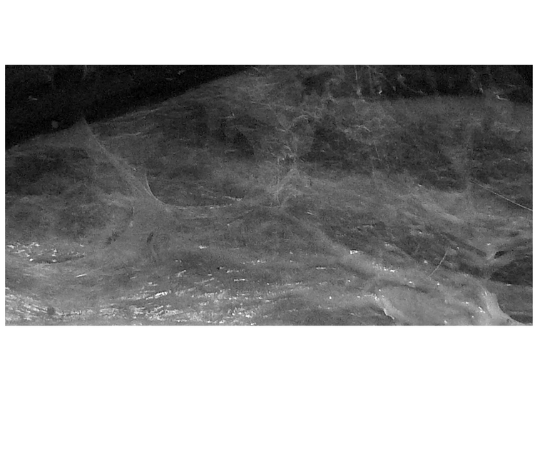 Fascia